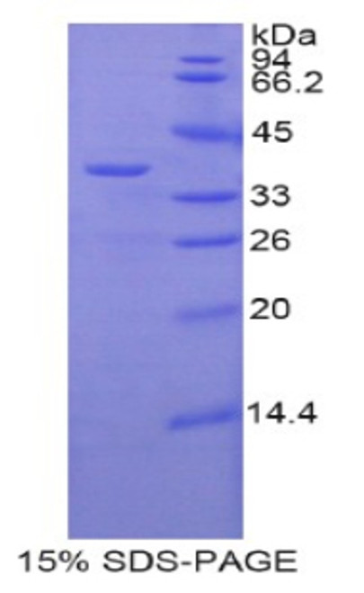 Mouse Recombinant Zeta Chain Associated Protein Kinase 70kDa (zAP70)