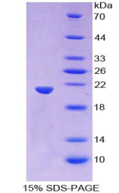 Human Recombinant Wingless Type MMTV Integration Site Family, Member 11 (WNT11)