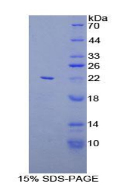 Rat Recombinant Linker For Activation Of T-Cells Family, Member 2 (LAT2)