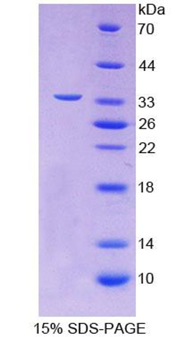 Human Recombinant Translocase Of Outer Mitochondrial Membrane 70A (TOMM70A)