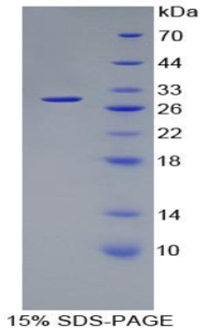 Human Recombinant Proteasome 26S Subunit, Non ATPase 10 (PSMD10)