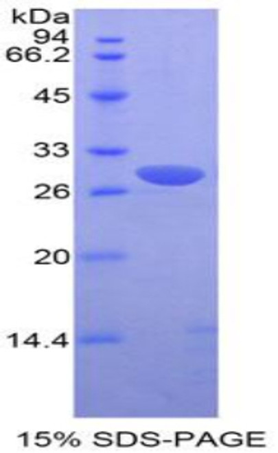 Mouse Recombinant Pim-2 Oncogene (PIM2)