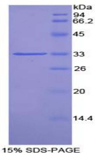 Rat Recombinant Pim-2 Oncogene (PIM2)
