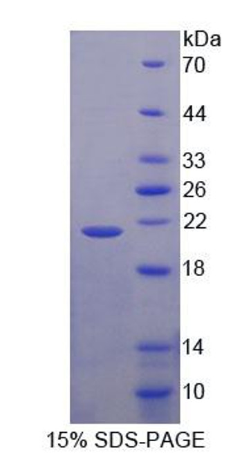 Human Recombinant Neuroblastoma, Suppression Of Tumorigenicity 1 (NBL1)