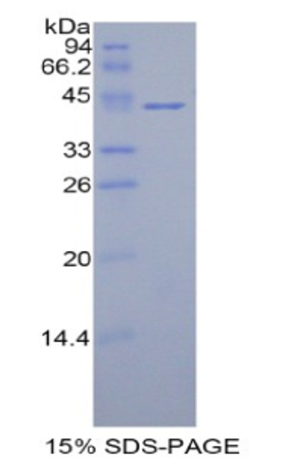 Human Recombinant Histone Cluster 1, H2ac (HIST1H2AC)