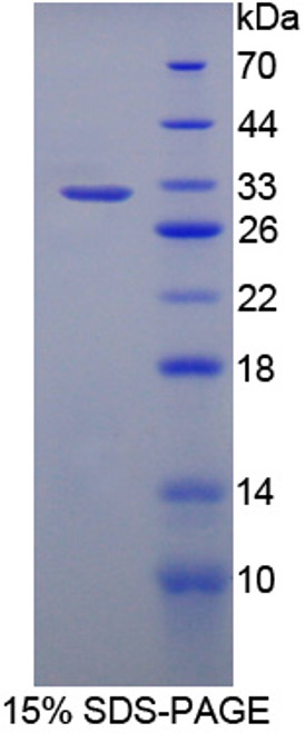 Rat Recombinant Leucine Rich Repeat Containing Protein 32 (LRRC32)