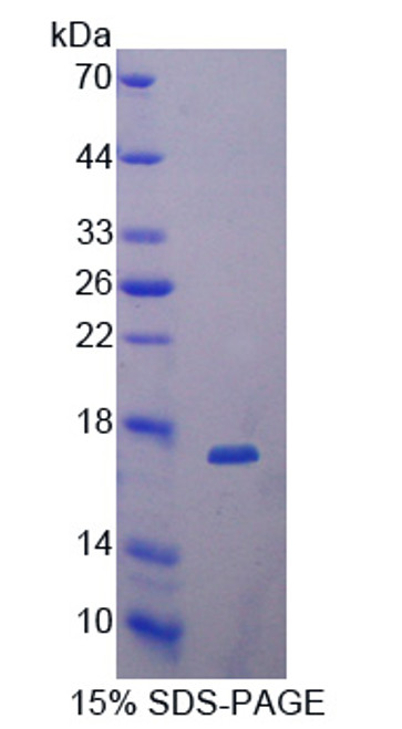 Human Recombinant Dickkopf Related Protein 4 (DKK4)