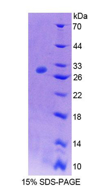 Rat Recombinant ATPase, Na+/K+ Transporting Beta 4 Polypeptide (ATP1b4)