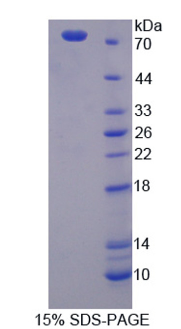 Human Recombinant Proteasome 26S Subunit, Non ATPase 6 (PSMD6)