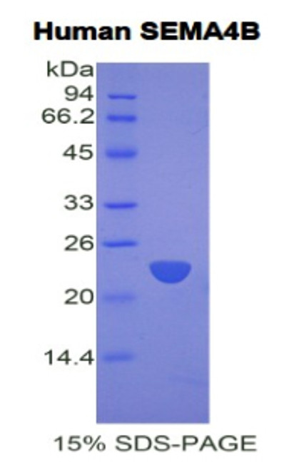 Human Recombinant Semaphorin 4B (SEMA4B)