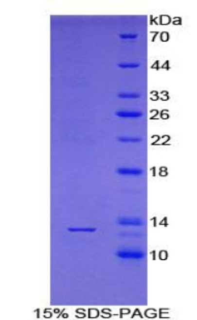 Human Recombinant Poly A Binding Protein Cytoplasmic 1 Like Protein (PABPC1L)