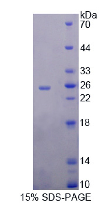 Human Recombinant Ribonuclease A9 (RNASE9)
