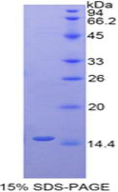 Human Recombinant Ly1 Antibody Reactive Homolog (LYAR)