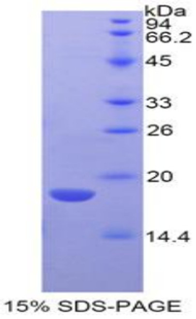 Mouse Recombinant Ly1 Antibody Reactive Homolog (LYAR)
