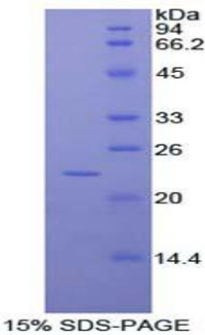 Human Recombinant RAD54 Like Protein 2 (RAD54L2)