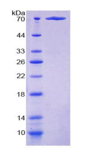 Human Recombinant Cancerous Inhibitor Of PP2A (CIP2A)