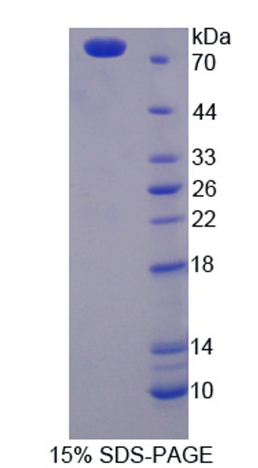 Mouse Recombinant Keratin 28 (KRT28)