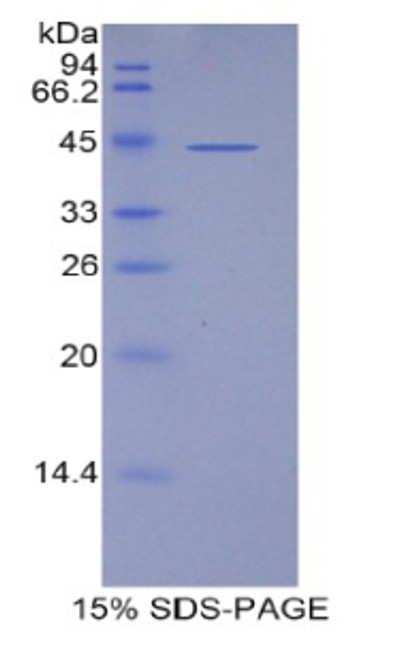 Human Recombinant Lipocalin 15 (LCN15)