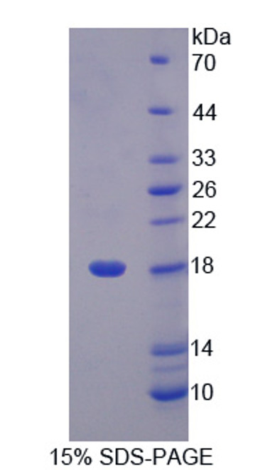 Rat Recombinant Lipocalin Like Protein 1 (LCNL1)