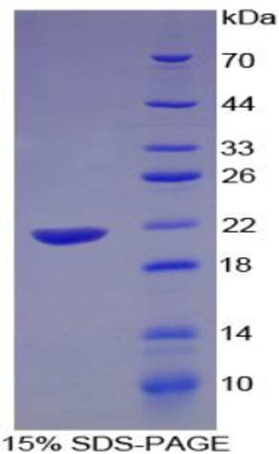 Human Recombinant Vascular Endothelial Growth Factor 145 (VEGF145)