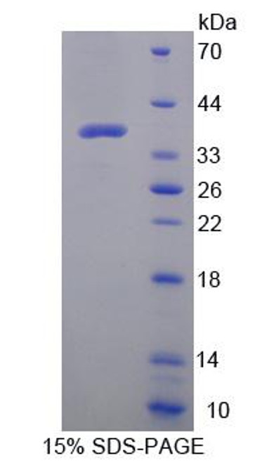 Human Recombinant Defensin Alpha 2 (DEFa2)