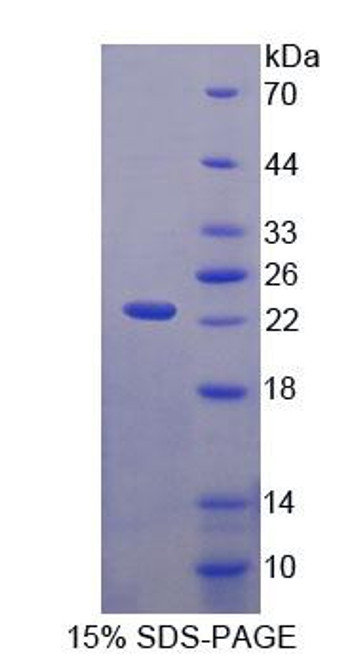 Human Recombinant Von Willebrand Factor A Domain Containing Protein 5B2 (vWA5B2)