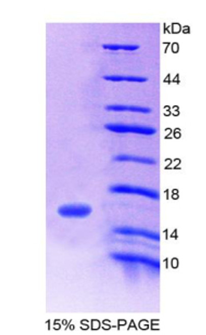 Human Recombinant Family With Sequence Similarity 132, Member A (FAM132A)