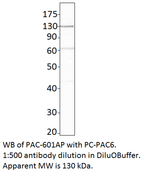 ADCY6 Antibody from Fabgennix