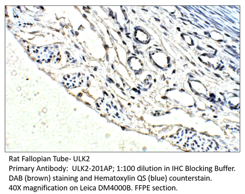 ULK2 Antibody from Fabgennix