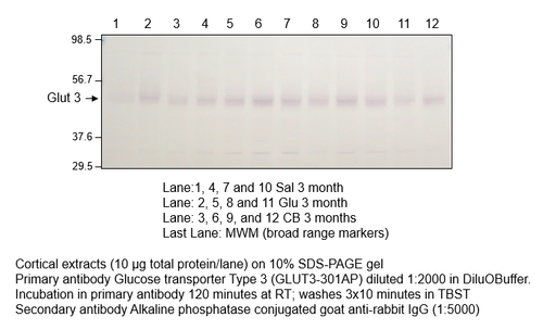 Glucose Transporter GLUT3 Antibody from Fabgennix