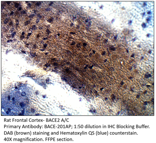 BACE2 A/C Antibody from Fabgennix