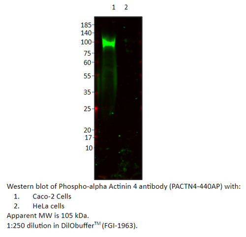 Phospho-alpha Actinin 4 (S159) Antibody from Fabgennix