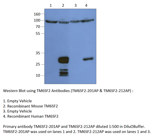 TM6SF2 Antibody from Fabgennix