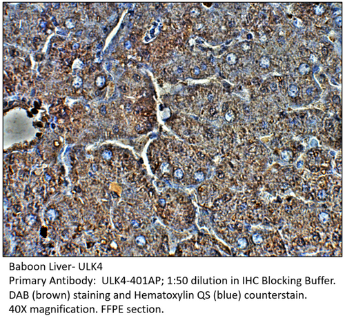 ULK4 Antibody from Fabgennix