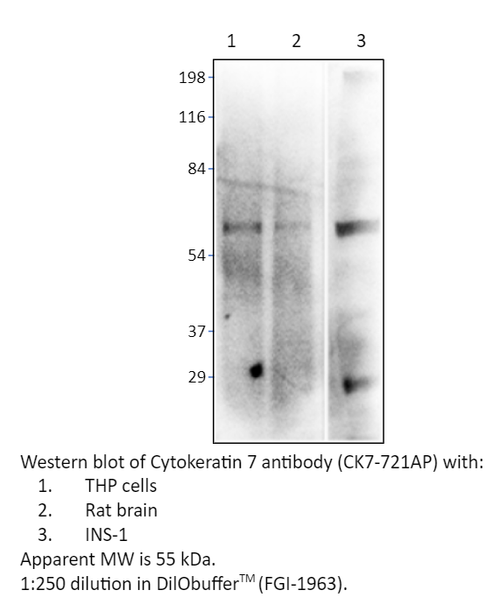 Cytokeratin 7 Antibody from Fabgennix