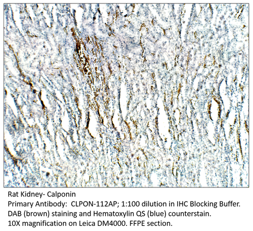 Calponin Antibody from Fabgennix