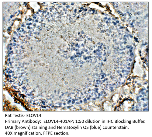 ELOVL4 Antibody from Fabgennix