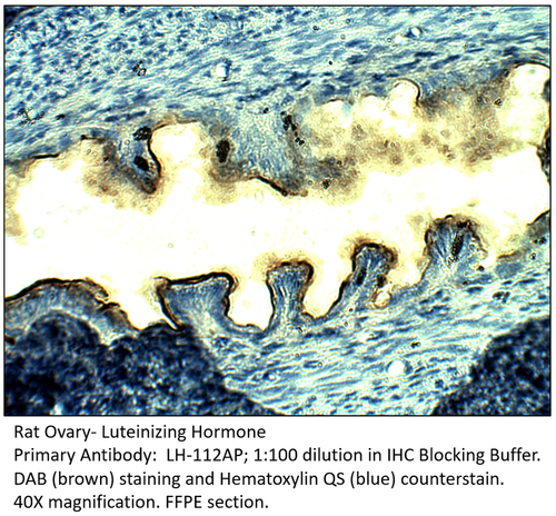 Luteinizing Hormone Antibody from Fabgennix