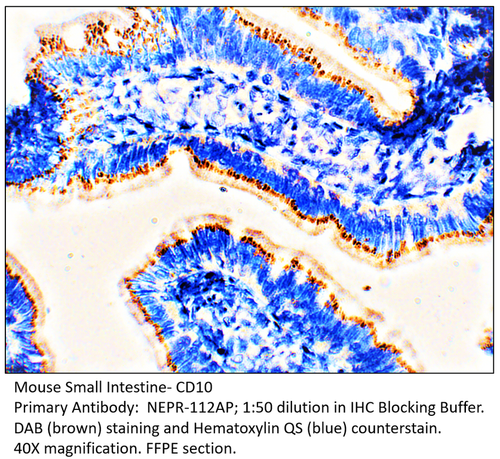CD10 Antibody from Fabgennix