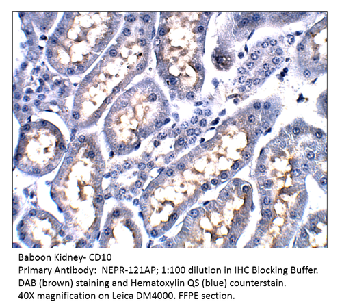 CD10 Antibody from Fabgennix