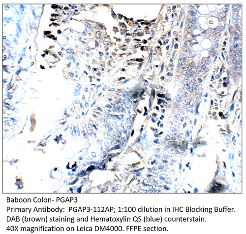 PGAP3 Antibody from Fabgennix