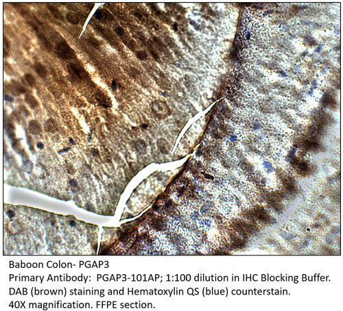 PGAP3 Antibody from Fabgennix