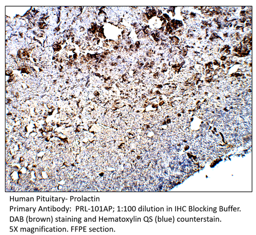 Prolactin Antibody from Fabgennix