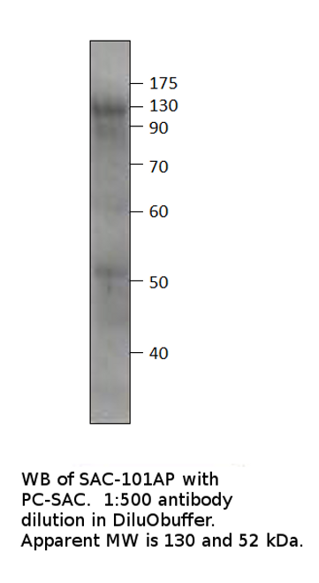 Soluble Adenylate Cyclase 1 Antibody from Fabgennix