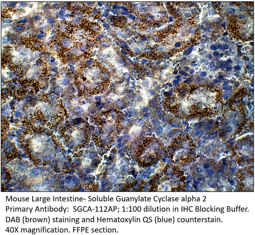 Soluble Guanylyl Cyclase alpha 2 Antibody from Fabgennix