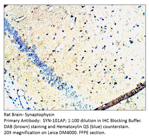 Synaptophysin Antibody from Fabgennix