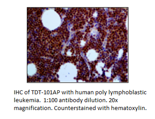 TdT Antibody from Fabgennix