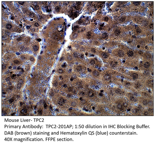 TPCN2 Antibody from Fabgennix
