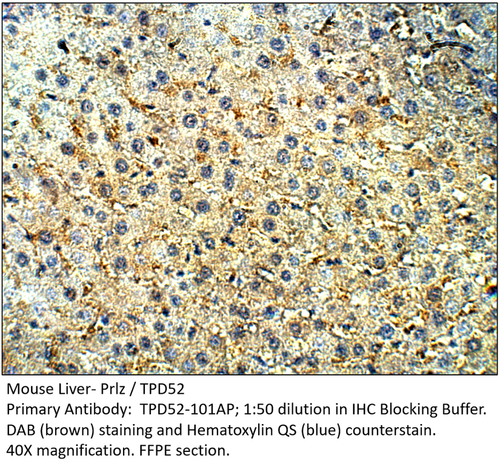 Prlz / TPD52 Antibody from Fabgennix