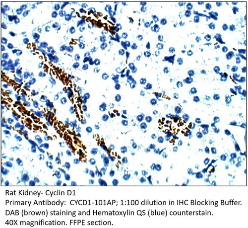 Cyclin D1 Antibody from Fabgennix